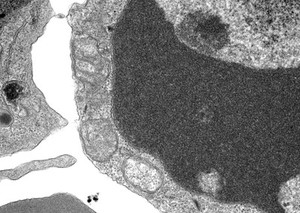view TEM cell in late stage of apoptosis, mitochondria swelling