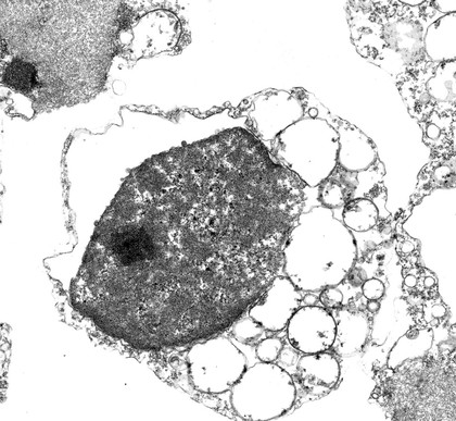 TEM cell undergoing necrosis.