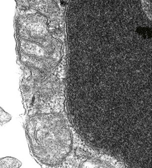 view TEM of swollen mitochondrion in apoptotic cell