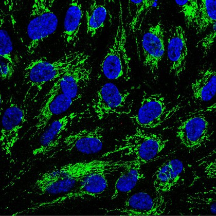 Caspase activity in a normal cell, confocal micrograph