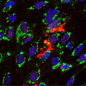 view Caspase activity in cell triggered to undergo apoptosis