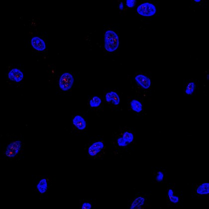 Free radical damage in apoptosis