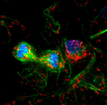 Cytokinesis in neural tube cells of chick embryo