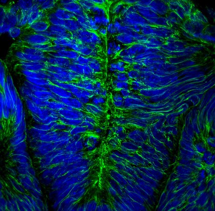 Neural tube in chick embryo, confocal