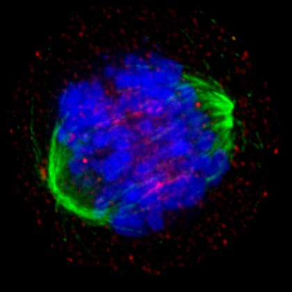 Human HeLa cancer cell in anaphase