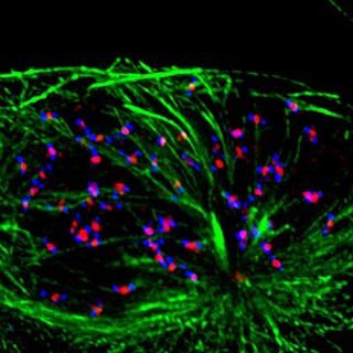 Human cancer cell