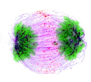 view Human HeLa cancer cells, anaphase