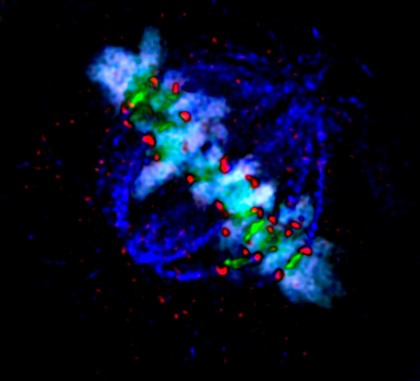 Human HeLa cancer cell, metaphase.