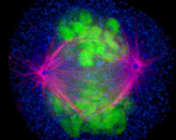 Human HeLa cancer cells, prometaphase