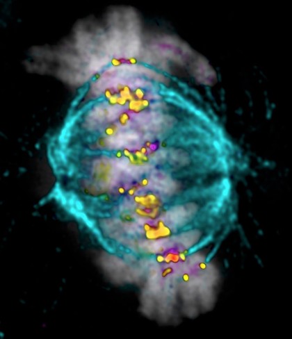 Human HeLa cancer cells, metaphase