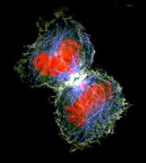 view Human HeLa cancer cells, cytokinesis