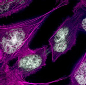 view Human HeLa cancer cells, cytokinesis