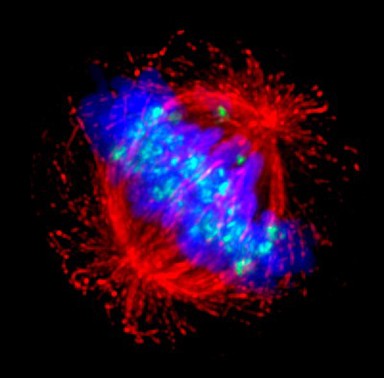 Human HeLa cancer cells, mitosis