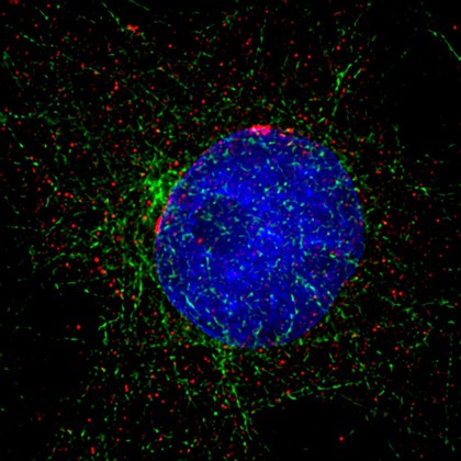 Xenopus cancer kidney cells, interphase