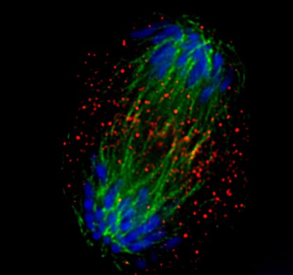 Xenopus cancer kidney cells, anaphase