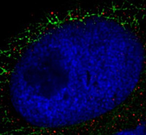 view Xenopus cancer kidney cells, interphase