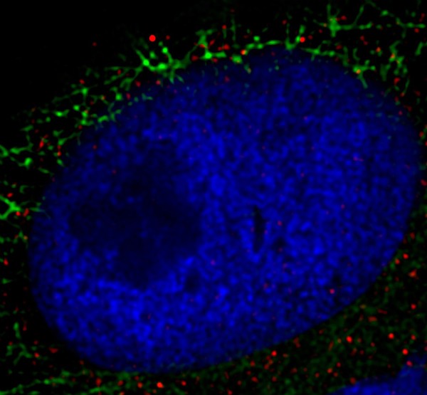 Xenopus cancer kidney cells, interphase