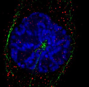 view Xenopus cancer kidney cells, prometaphase