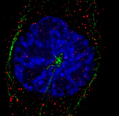 Xenopus cancer kidney cells, prometaphase