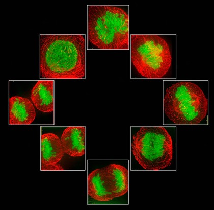 Human HeLa cancer cells, stages of mitosis