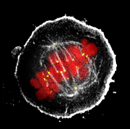 Human HeLa cancer cells, metaphase