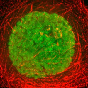 view Human HeLa cancer cell in prophase of mitosis