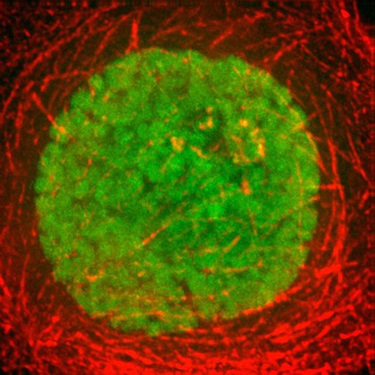 Human HeLa cancer cell in prophase of mitosis