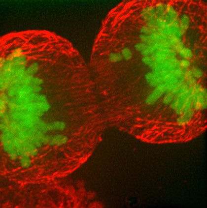 Human HeLa cancer cell in anaphase of mitosis