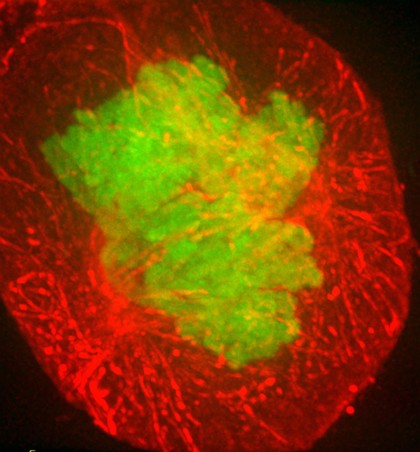 Human HeLa cancer cell in late prometaphase of mitosis
