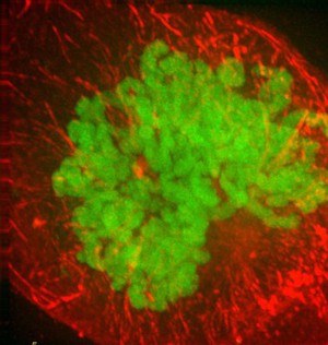 view Human HeLa cancer cell in prometaphase of mitosis