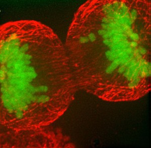 view Human HeLa cancer cell in late anaphase of mitosis