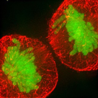 Human HeLa cancer cell in telophase of mitosis