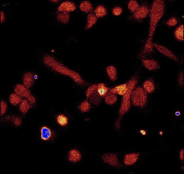 Movie of calcium waves during apoptosis, confocal