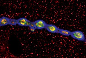 view Ubiquitin ligase at Drosophila neuromuscular junction