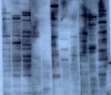 The first DNA fingerprint. The first three lanes contain DNA from a woman, her mother and her father respectively. Lanes 4 - 11 contain DNA from assorted other species including mouse, baboon, lemur, cow, grey seal and tobacco (last lane). The DNA probe used in this experiment detected tandomly repeated short stretches of DNA called minisatellites whose length varies between individuals.