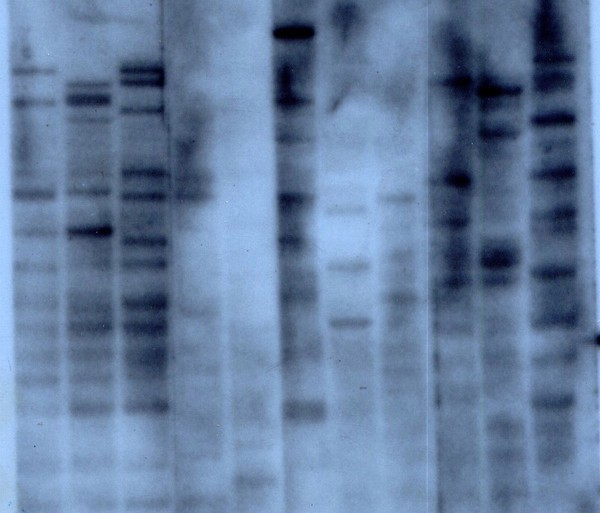The first DNA fingerprint. The first three lanes contain DNA from a woman, her mother and her father respectively. Lanes 4 - 11 contain DNA from assorted other species including mouse, baboon, lemur, cow, grey seal and tobacco (last lane). The DNA probe used in this experiment detected tandomly repeated short stretches of DNA called minisatellites whose length varies between individuals.