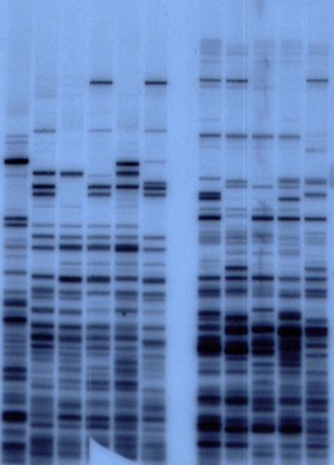 view An early DNA fingerprint showing DNA patterns from a mother (lanes 2 and 8) and her four children (adjacent lanes to the right). Lane 1 is an unrelated person. The two sets of lanes show the fingerprints reveled with two different probes that detect different types of repeated sequences.