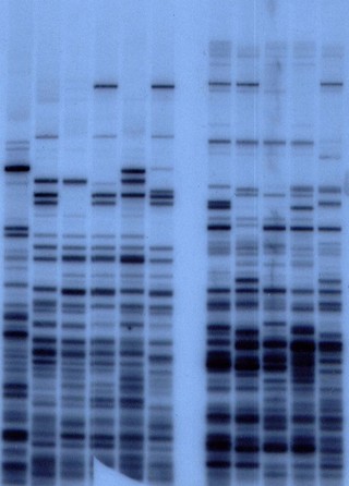 An early DNA fingerprint showing DNA patterns from a mother (lanes 2 and 8) and her four children (adjacent lanes to the right). Lane 1 is an unrelated person. The two sets of lanes show the fingerprints reveled with two different probes that detect different types of repeated sequences.