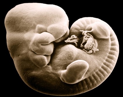 SEM of mouse foetus