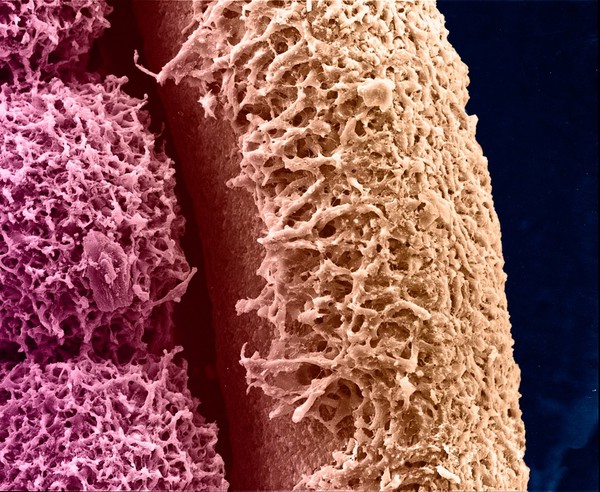 Neural tube and somites
