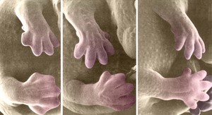 view Development of the limbs in a mouse embryo. The feet begin as a paddle shapes with the digits being created by the programmed death of tissue in the interdigital regions.