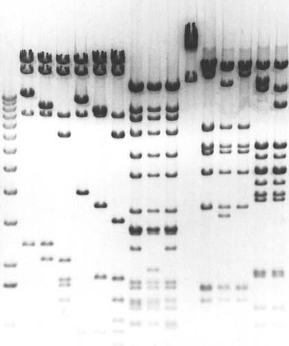 Separation of DNA fragments by electrophoresis through an agarose gel. An electric current is passed through the gel and separates the DNA fragments according to size. The mixture of fragments is applied to a well at the top of the gel before the current is started. The smaller fragments travel further and reach the bottom of the gel while the larger ones remain towards the origin.