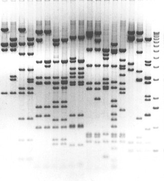 DNA bands on a gel