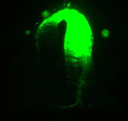 Spinal cord showing presence of siRNA