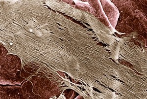 view SEM of meshed skin graft over a burn.