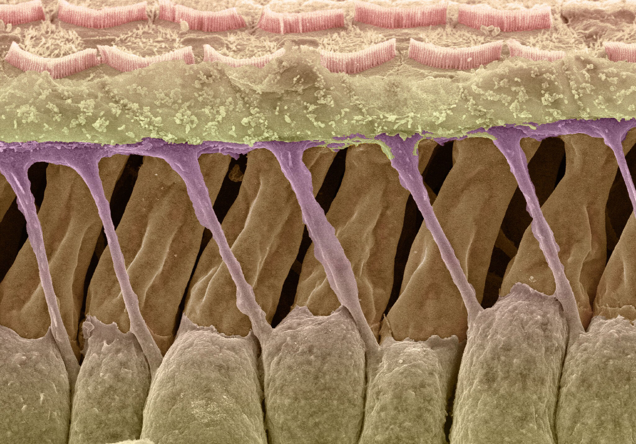 outer-hair-cells-and-deiter-s-cells-in-the-cochlea-wellcome-collection