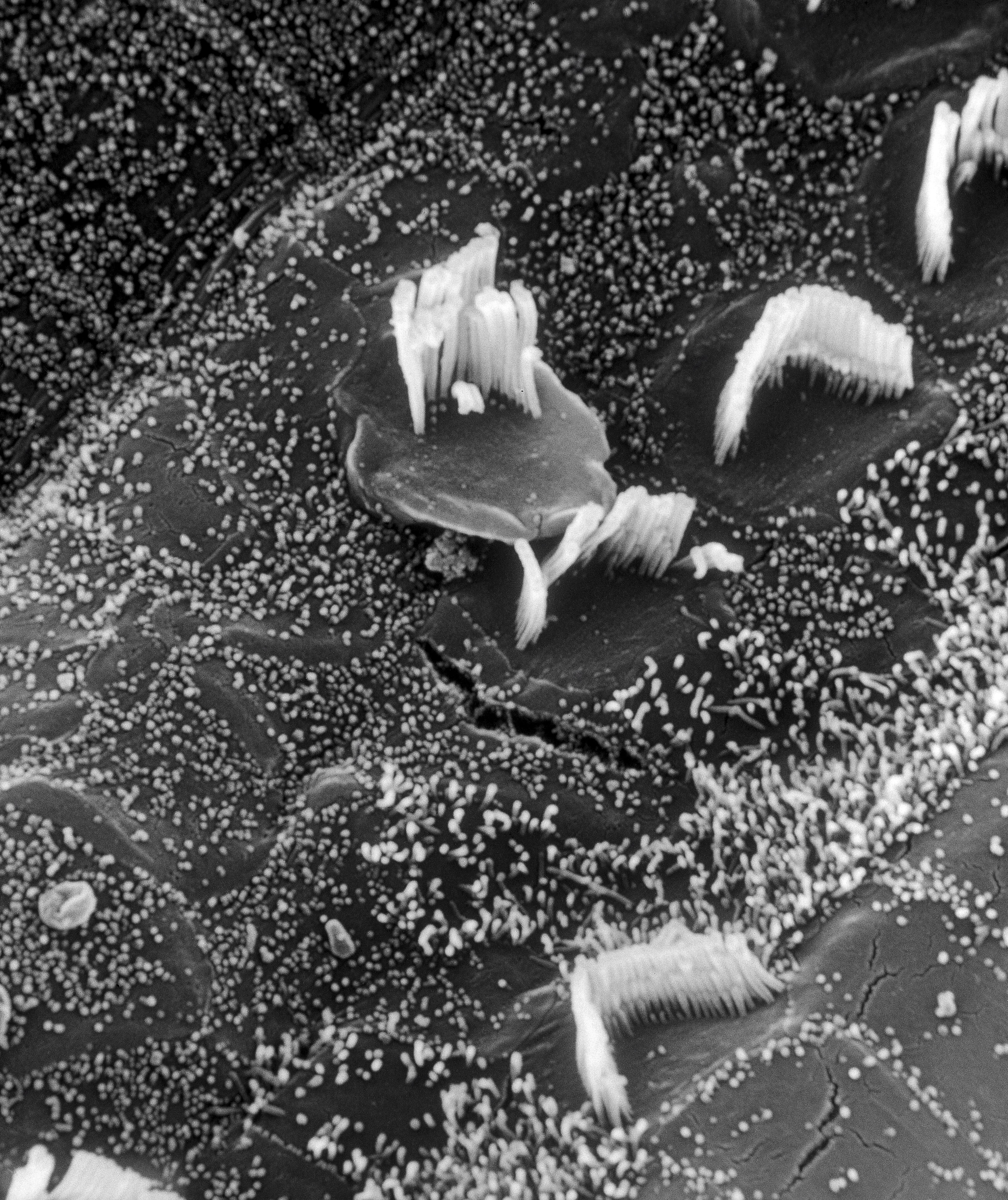 Hair cells in the cochlea damaged by old age
