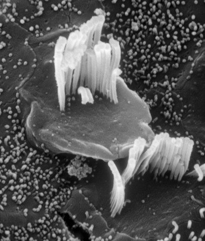 Hair cells in the cochlea damaged by old age