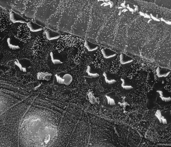 Hair cells in the cochlea damaged by old age