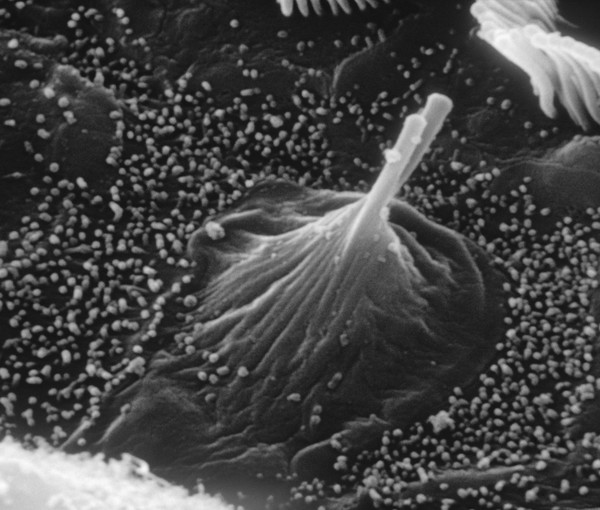 Hair cells in the cochlea damaged by old age